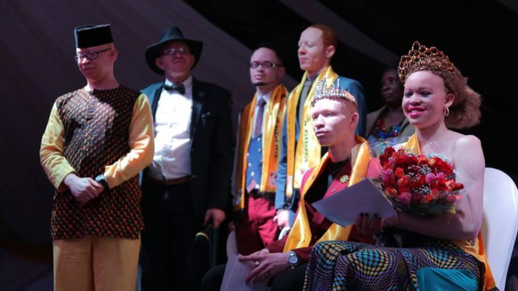Un concours de beauté pour les albinos.