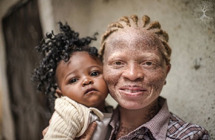 ONG « Plus de couleur »